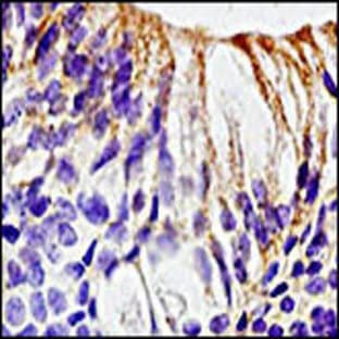 anti-CD28 (CD28) (N-Term) antibody avatar