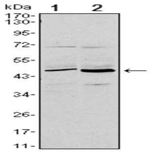 anti-CD86 Molecule (CD86) antibody avatar