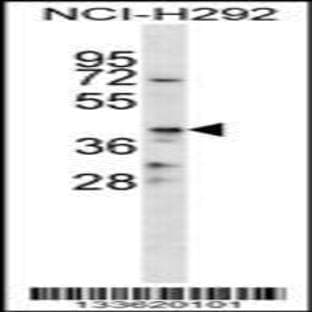 anti-CD86 Molecule (CD86) (C-Term), (AA 269-298) antibody avatar