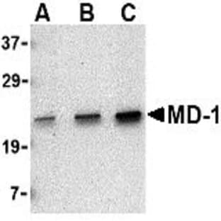 anti-CD86 Molecule (CD86) antibody avatar