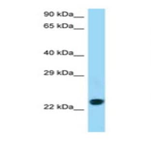 anti-CD86 Molecule (CD86) (C-Term) antibody avatar