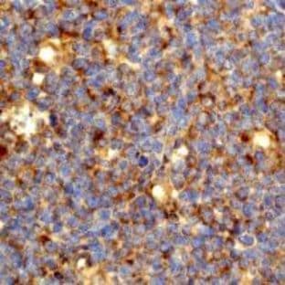 anti-CD86 Molecule (CD86) (N-Term) antibody avatar