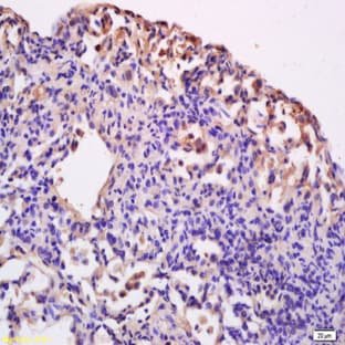 anti-CD86 Molecule (CD86) antibody avatar