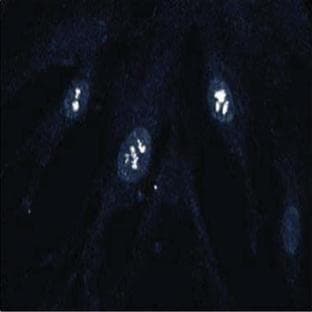 anti-Cyclin-Dependent Kinase 4 (CDK4) (AA 1-303) antibody avatar