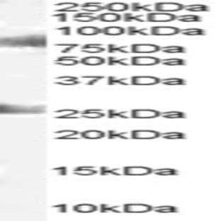 anti-Chromodomain Protein, Y-Like (CDYL) (C-Term) antibody avatar