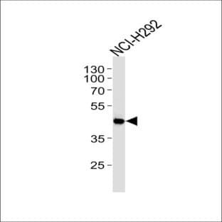 anti-Absent in Melanoma 2 (AIM2) (AA 1-32) antibody avatar