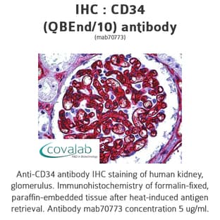 anti-CD34 Molecule (CD34) antibody avatar