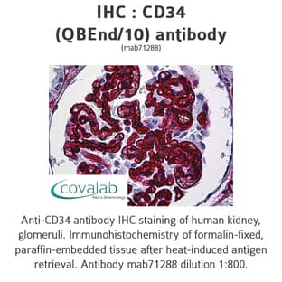 anti-CD34 Molecule (CD34) antibody avatar