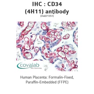 anti-CD34 Molecule (CD34) antibody avatar