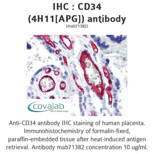 anti-CD34 Molecule (CD34) antibody avatar