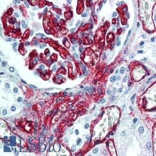 anti-CD34 Molecule (CD34) antibody avatar