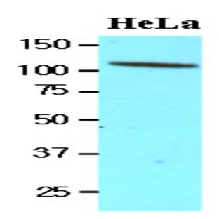 anti-CD34 Molecule (CD34) (AA 32-290) antibody avatar