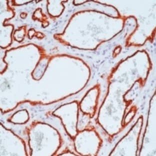 anti-CD34 Molecule (CD34) antibody avatar