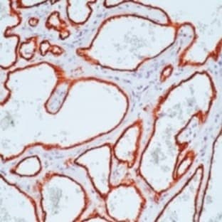 anti-CD34 Molecule (CD34) antibody avatar