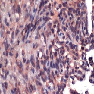 anti-CD34 Molecule (CD34) antibody avatar