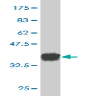 anti-CD34 Molecule (CD34) (AA 32-141) antibody avatar