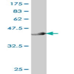anti-CD34 Molecule (CD34) (AA 32-141) antibody avatar