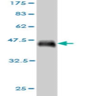 anti-CD34 Molecule (CD34) (AA 32-141) antibody avatar