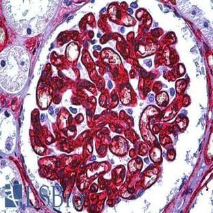 anti-CD34 Molecule (CD34) antibody avatar