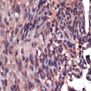 anti-CD34 Molecule (CD34) antibody avatar