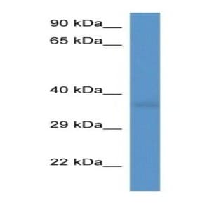 anti-CD34 Molecule (CD34) antibody avatar
