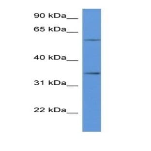 anti-CD34 Molecule (CD34) antibody avatar