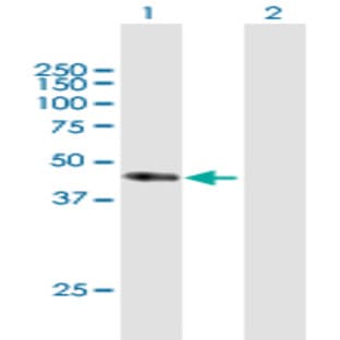 anti-CD34 Molecule (CD34) (AA 1-373) antibody avatar