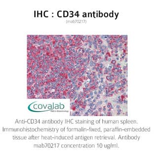 anti-CD34 Molecule (CD34) antibody avatar