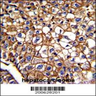 anti-CD34 Molecule (CD34) (AA 185-214), (Center) antibody avatar