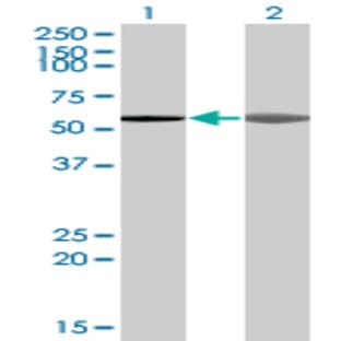 anti-A Kinase (PRKA) Anchor Protein 5 (AKAP5) (AA 334-428) antibody avatar