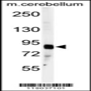 anti-ADAM Metallopeptidase with Thrombospondin Type 1 Motif, 4 (ADAMTS4) (C-Term), (AA 705-736) antibody avatar