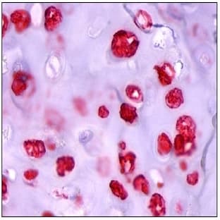 anti-ADAM Metallopeptidase with Thrombospondin Type 1 Motif, 4 (ADAMTS4) antibody avatar