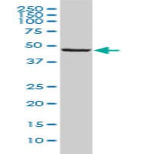 anti-BCL2-Associated Athanogene 5 (BAG5) (AA 1-448) antibody avatar