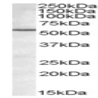 anti-BCL2-Associated Athanogene 5 (BAG5) (Internal Region) antibody avatar