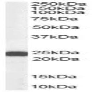 anti-BCL2-Associated Athanogene 2 (BAG2) (C-Term) antibody avatar