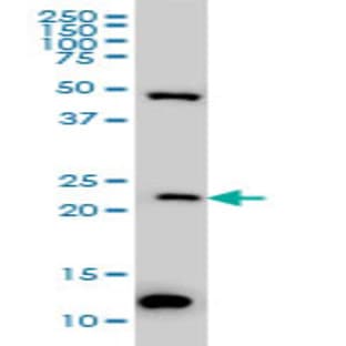 anti-BCL2-Associated Athanogene 2 (BAG2) (AA 102-212) antibody avatar