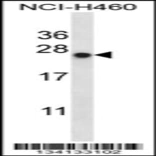 anti-BCL2-Associated Athanogene 2 (BAG2) (C-Term), (AA 148-176) antibody avatar