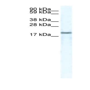 anti-Chemokine (C-X-C Motif) Ligand 14 (CXCL14) (Middle Region) antibody avatar