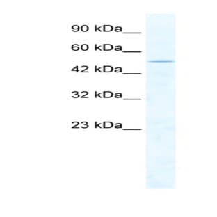 anti-Chromodomain Helicase DNA Binding Protein 1-Like (CHD1L) (Middle Region) antibody avatar