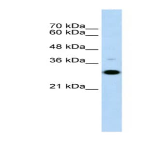 anti-CD40 Molecule, TNF Receptor Superfamily Member 5 (CD40) (N-Term) antibody avatar