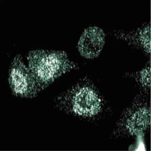 anti-CD40 Molecule, TNF Receptor Superfamily Member 5 (CD40) (AA 71-187) antibody avatar