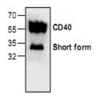 anti-CD40 Molecule, TNF Receptor Superfamily Member 5 (CD40) antibody avatar