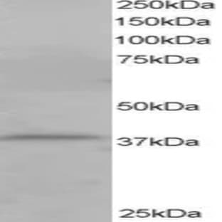 anti-Cytohesin 1 Interacting Protein (CYTIP) (N-Term) antibody avatar