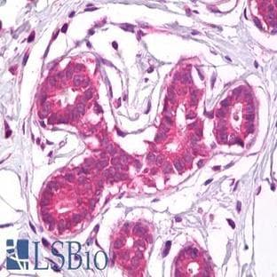 anti-CD44 (CD44) antibody avatar