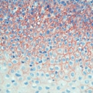 anti-CD44 (CD44) antibody avatar