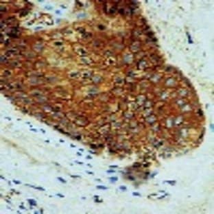 anti-CD44 (CD44) (Exon v4) antibody avatar