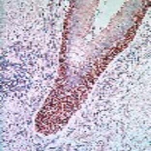 anti-CD44 (CD44) (Exon v5) antibody avatar