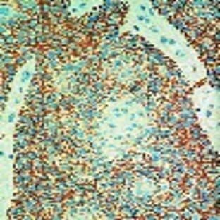 anti-CD44 (CD44) (Exon v6) antibody avatar