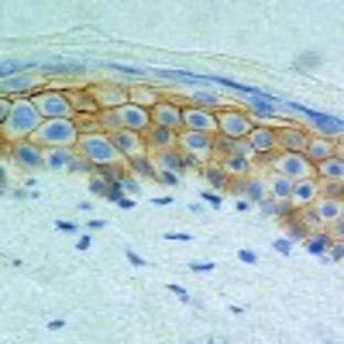 anti-CD44 (CD44) (Exon v7) antibody avatar