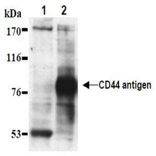 anti-CD44 (CD44) antibody avatar